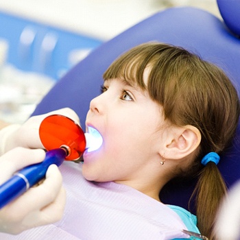 A young girl with her mouth open and a dentist using a curing light to harden the dental sealant